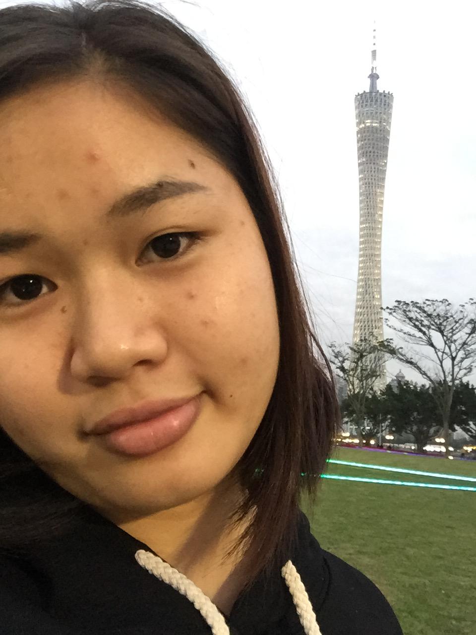 脸上的痘痘总是消不掉,有什么简单有效的药可