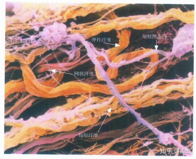 网状纤维染色分级图片