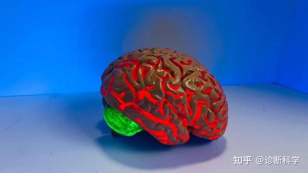 Biomedicines Journal | 对脑组织生化分析将为创伤性脑损伤诊断提供新的信息 - 知乎