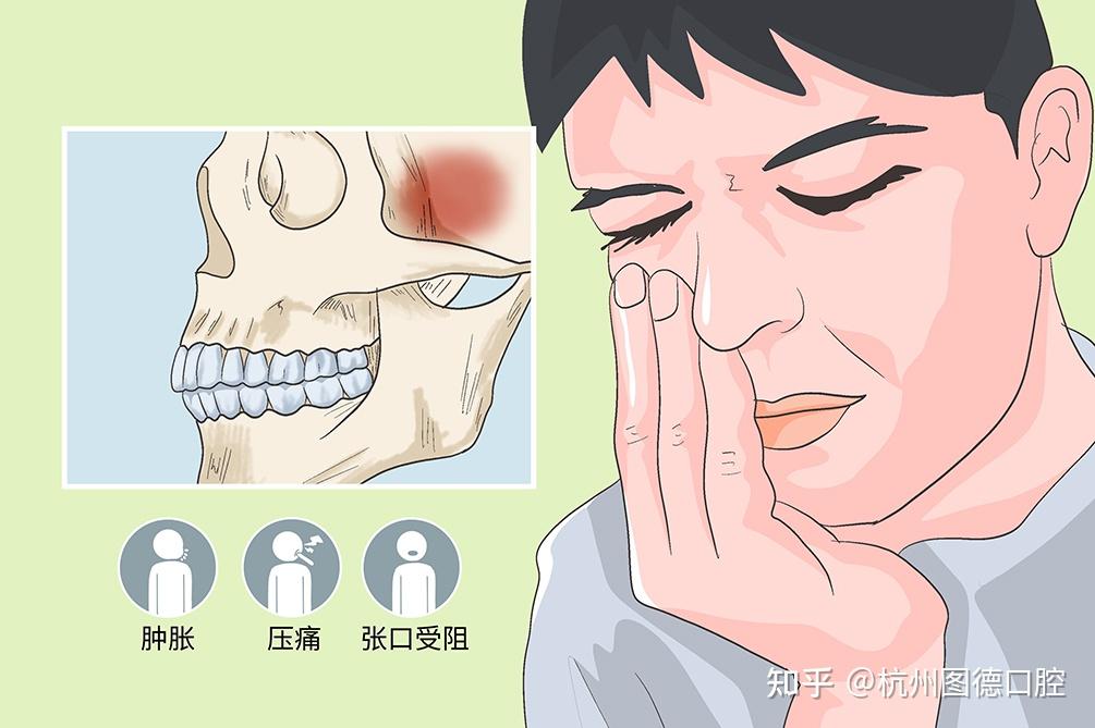张嘴疼痛、开口受限、开口嘴歪向一侧？你的颞下颌关节病了，看完就明白了！ - 知乎