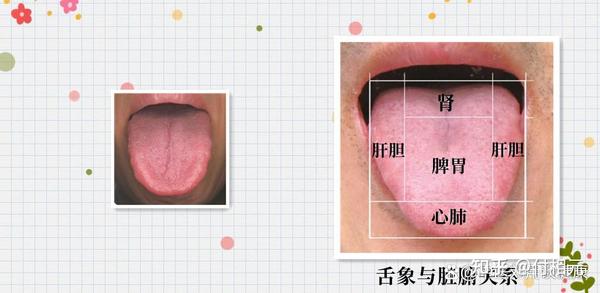 舌头有裂纹,齿痕?6种常见舌象的调理方法,看看你属于哪一种? - 知乎