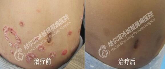 花吐症唯美图片 帅气男生花吐病图片 飞鸟症