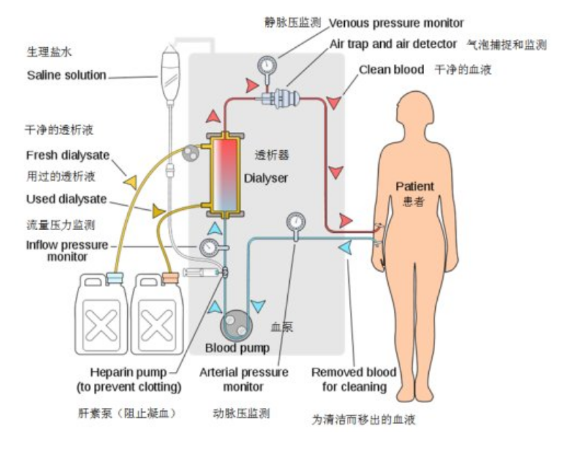 人工肾透析液图片