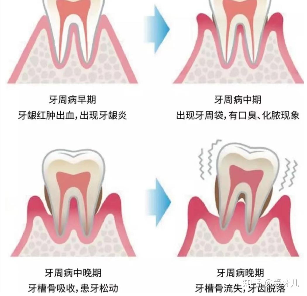 牙科镜检查的牙医的部分看法女人牙牙科口腔口腔牙齿图片下载 - 觅知网