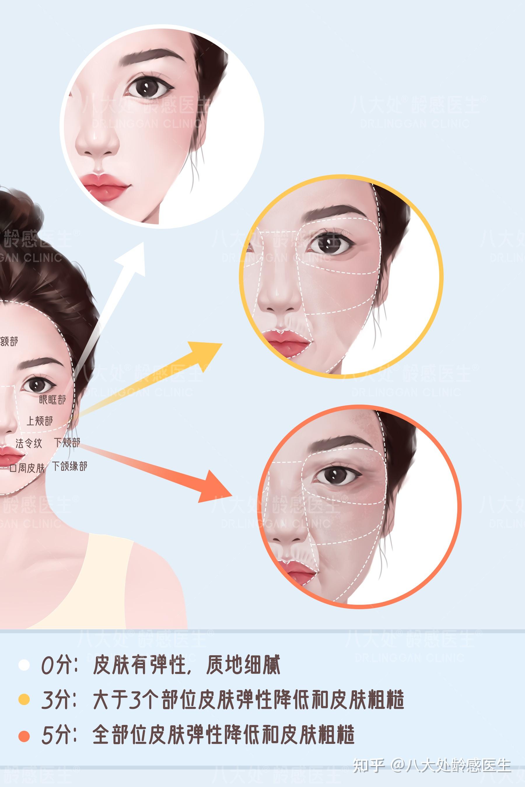 你的肌肤光老化到了哪个阶段?强烈建议每个人都来测一下! - 知乎