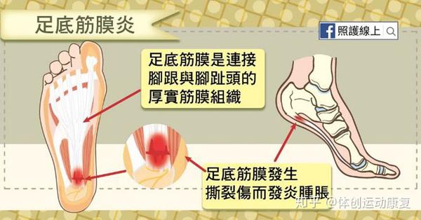 为什么有时候走路时脚底有一种撕裂的感觉 左脚一走路脚底筋疼 朴乐网