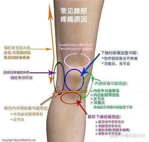 退行性关节炎应该如何应对呢 知乎