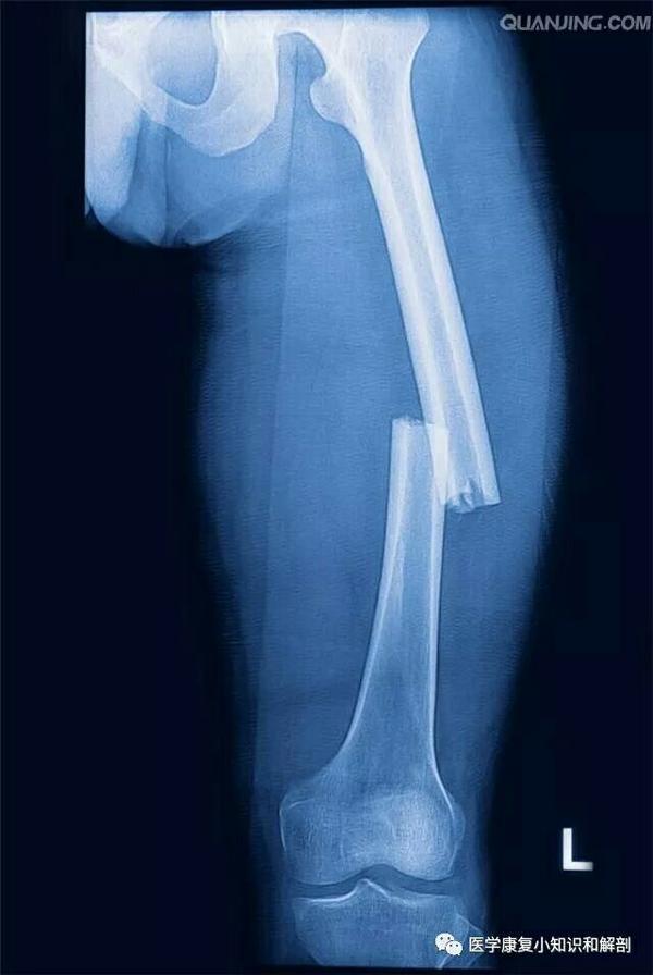 让我们一起复 骨 知乎