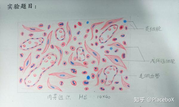 【病理学实验红蓝铅笔绘图】细胞的适应，损伤与修复- 知乎