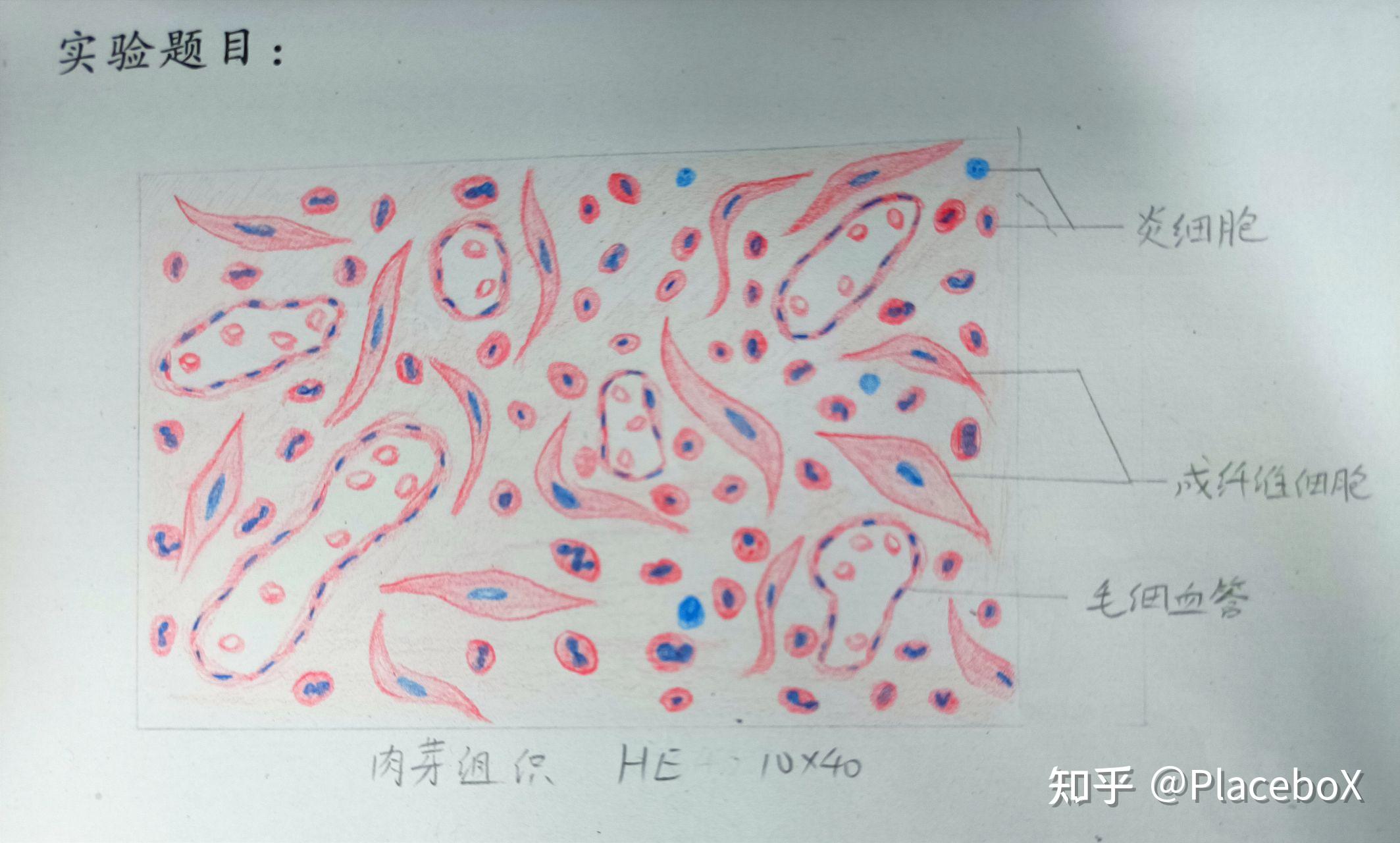血细胞红蓝铅笔图片
