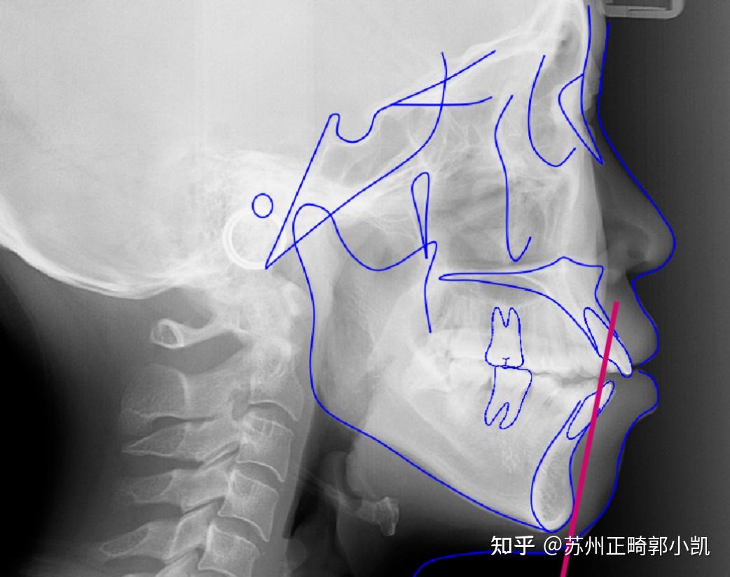 但不意味成年人就無法擁有