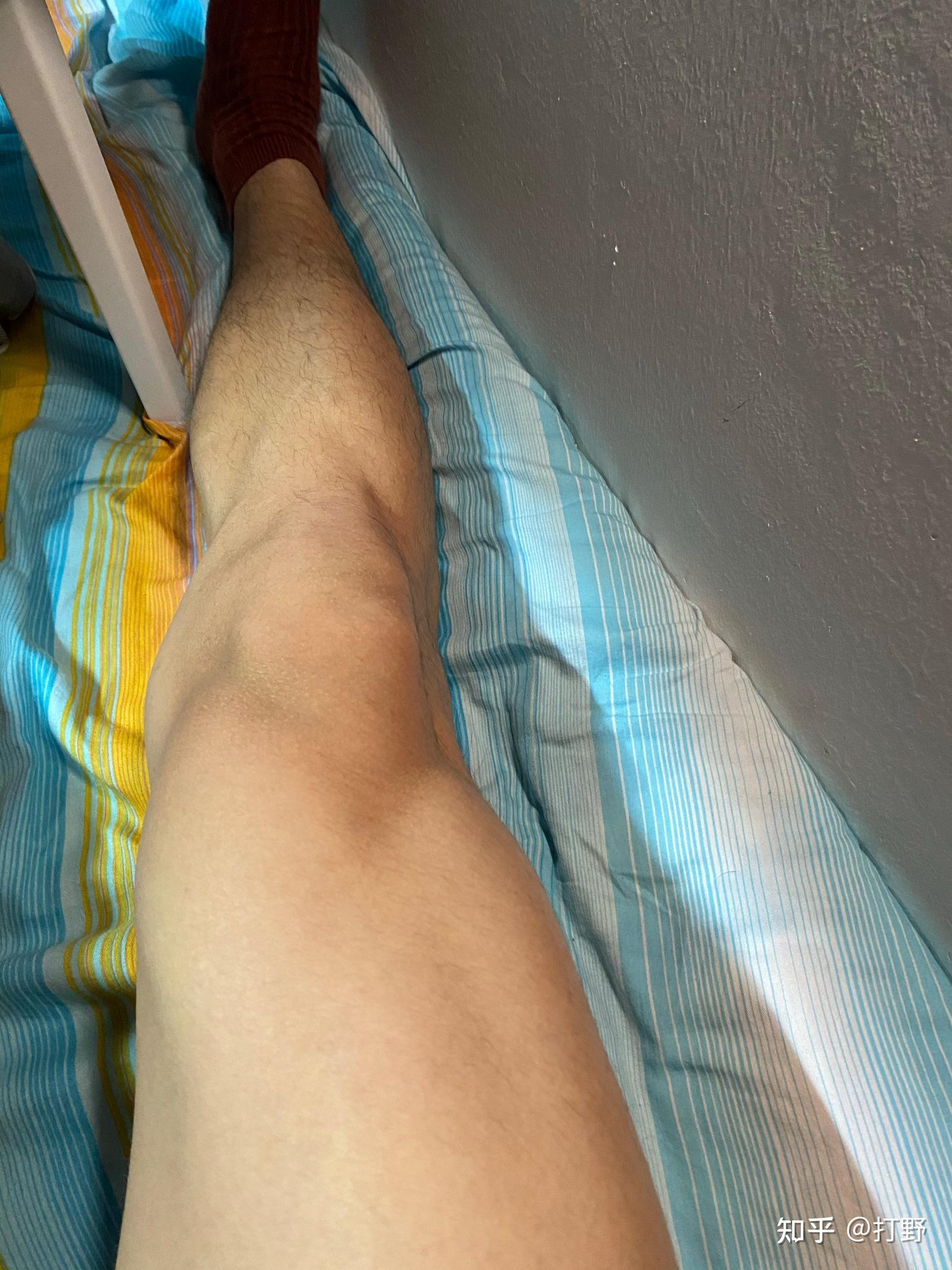 男生什么样的腿比较好看