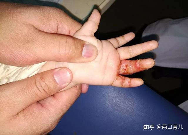 2岁幼童把洗衣凝珠当糖吃若家长不收好危险物品会伤害孩子