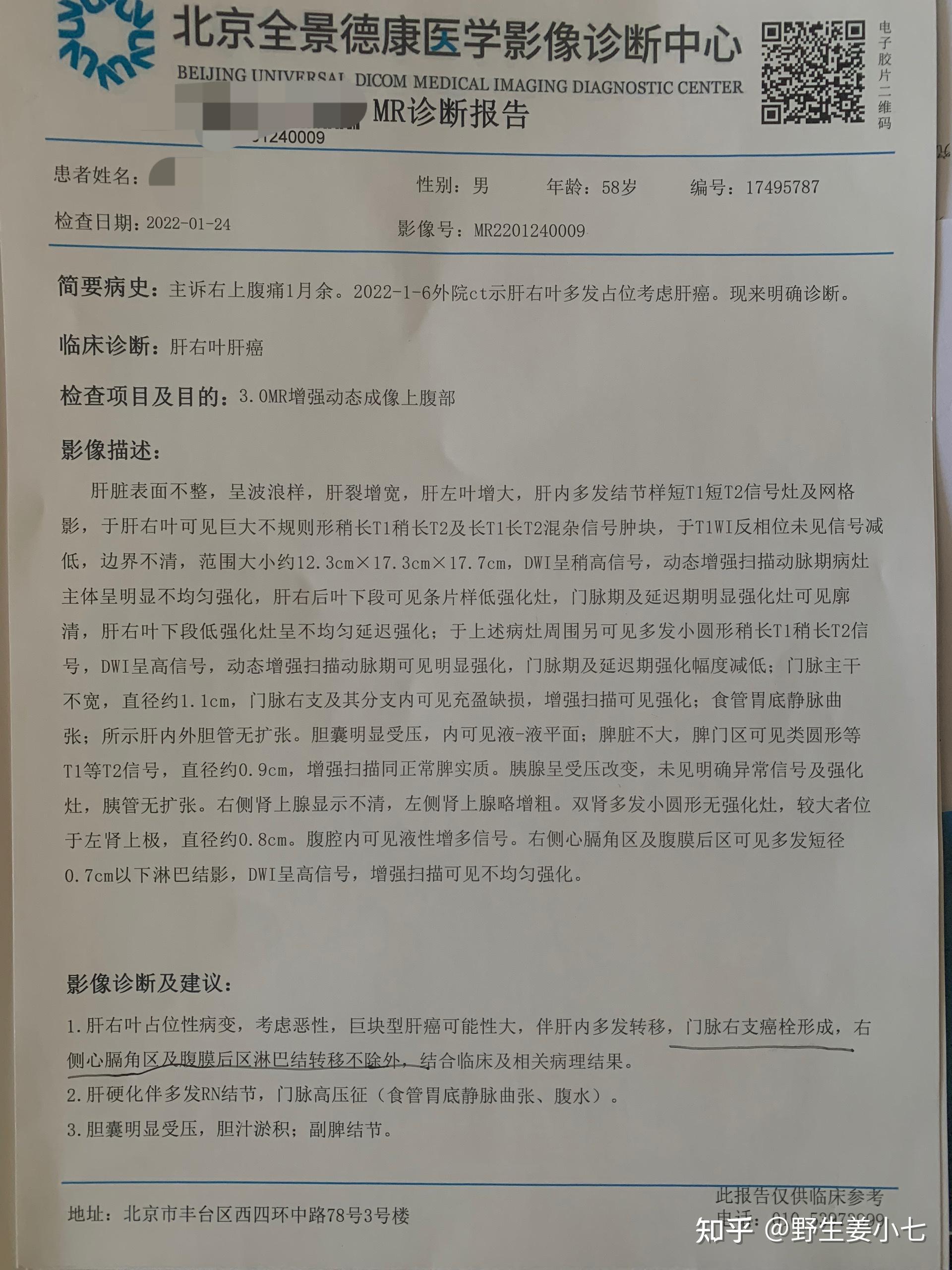 我们与肝癌晚期的战斗(十五)