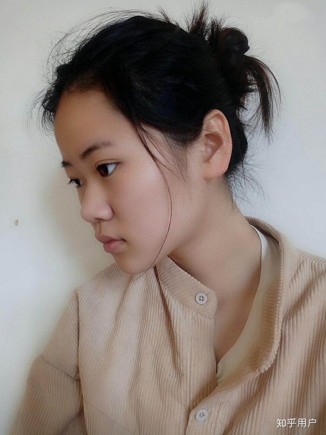 女孩子塌鼻梁山根低是怎样的体验